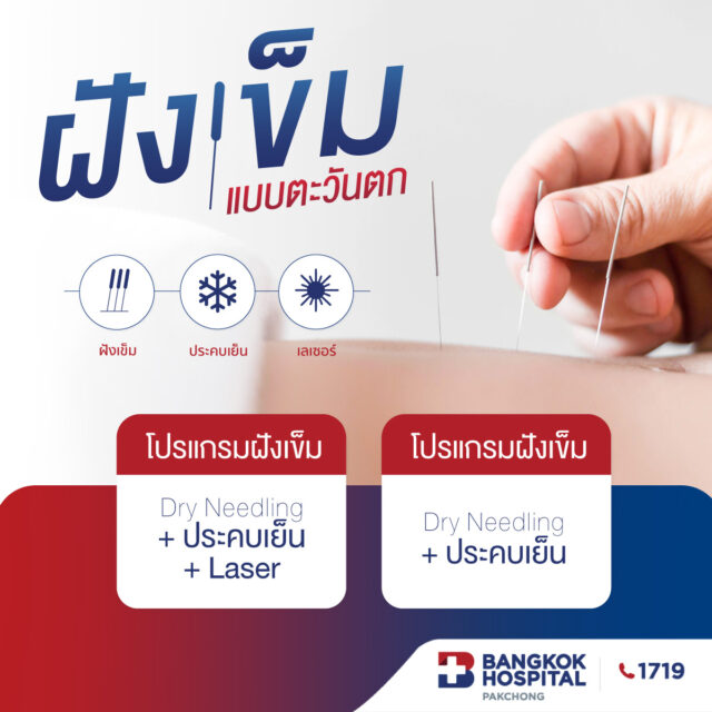 แพ็กเกจฝังเข็มแบบตะวันตก