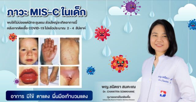 MIS-C in Children After COVID-19 Infection Image