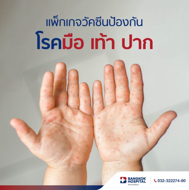 แพ็กเกจวัคซีนป้องกันโรคมือ เท้า ปาก