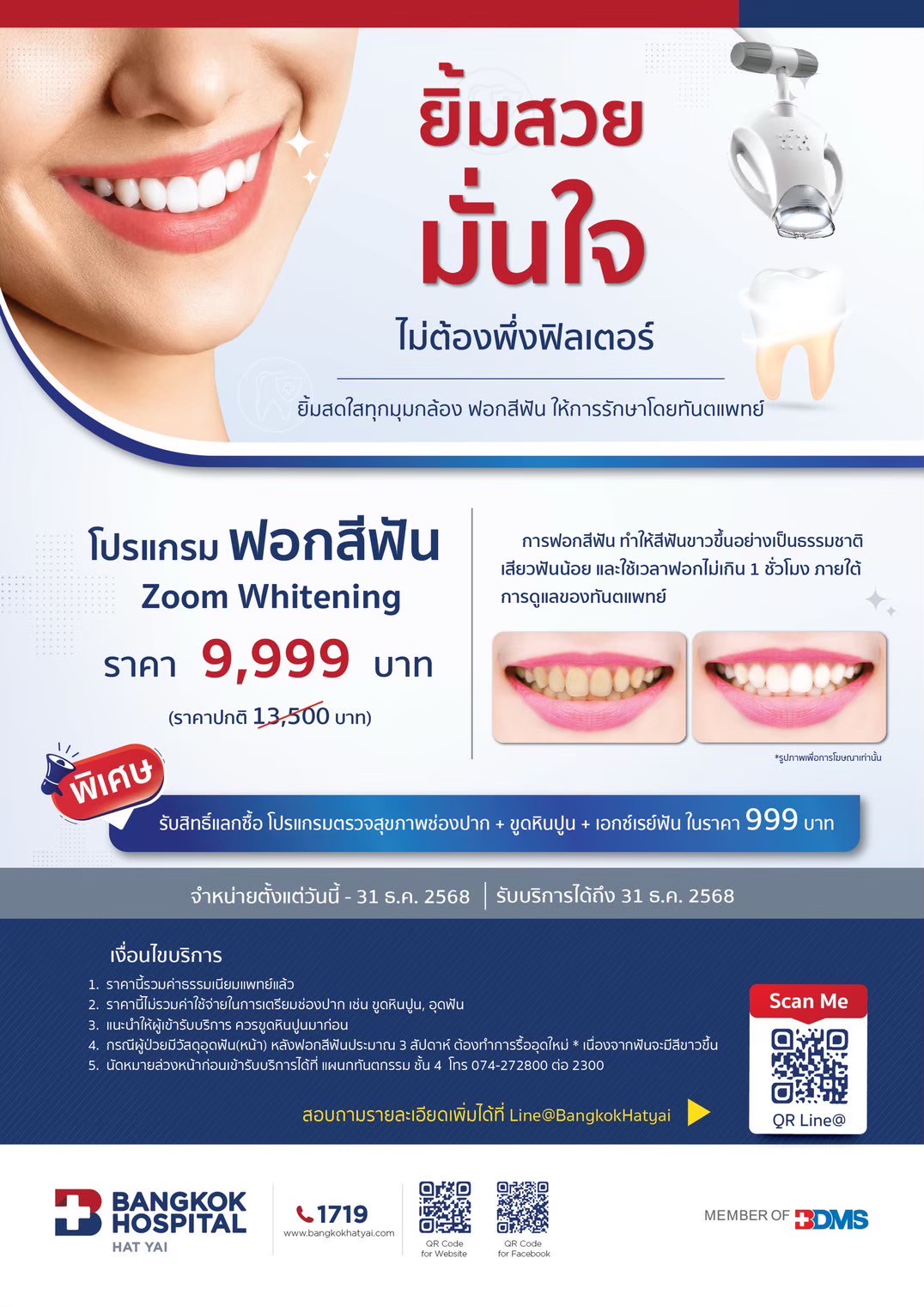 โปรแกรมฟอกสีฟัน  zoom whitening