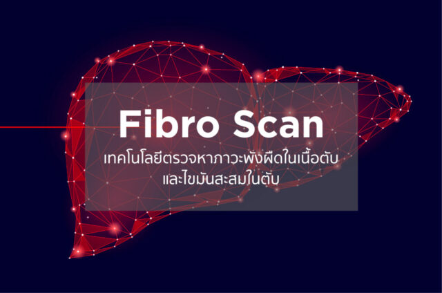 Fibro Scan Image