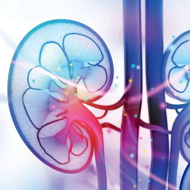 باقات غسيل الكلى