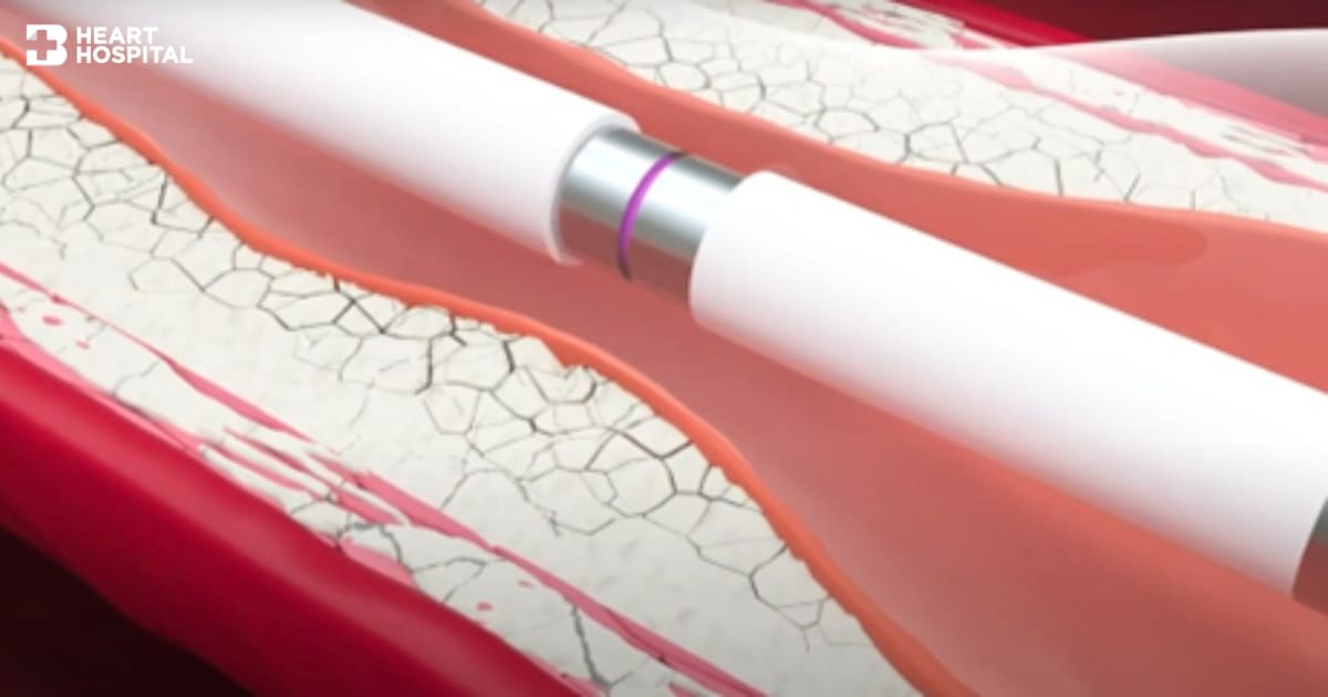 Doctor article image