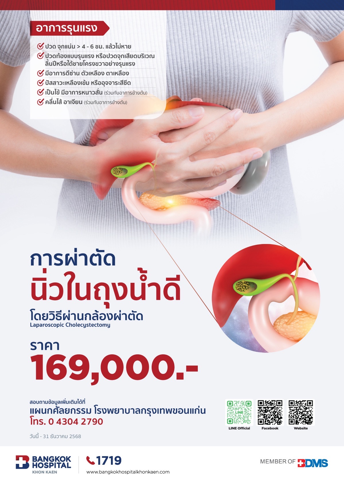 การผ่าตัดนิ่วในถุงน้ำดีโดยวิธีผ่านกล้องผ่าตัด