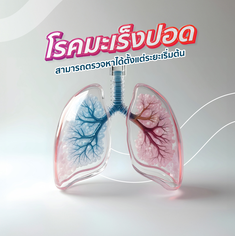 แพ็กเกจค้นหามะเร็งปอดระยะเริ่มต้น ด้วยเครื่องเอกซเรย์คอมพิวเตอร์แบบใช้ปริมาณรังสีต่ำ