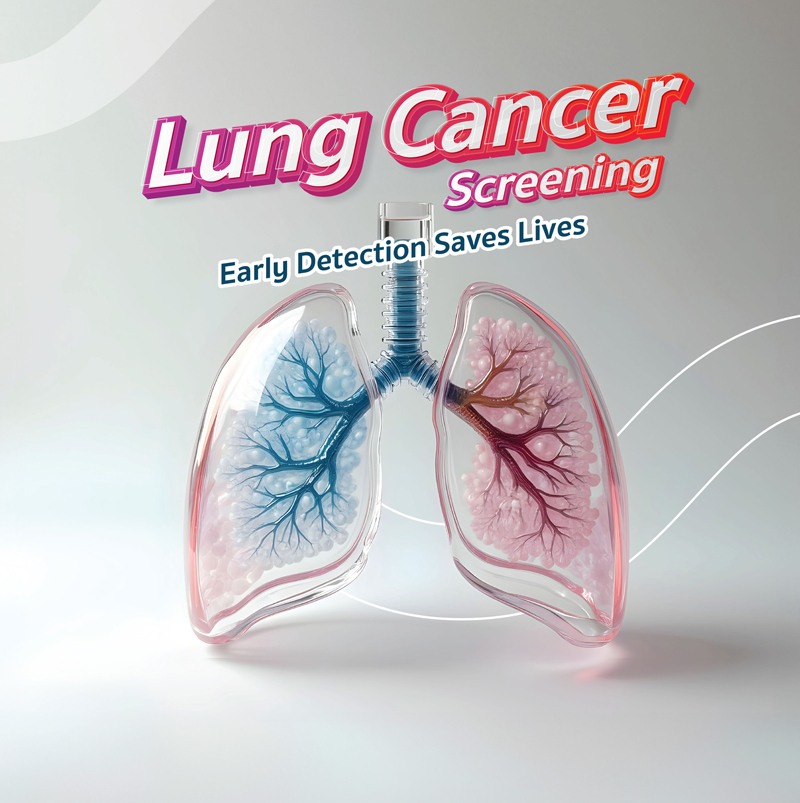 Low-Dose CT Chest Screening (LDCT)
