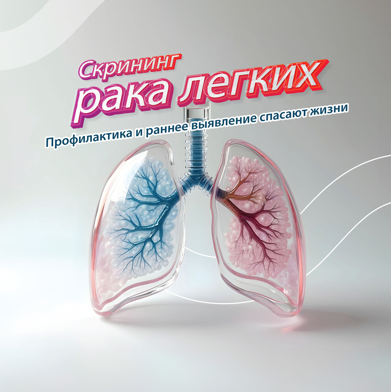 Низкодозная КТ грудной клетки (НДКТ)