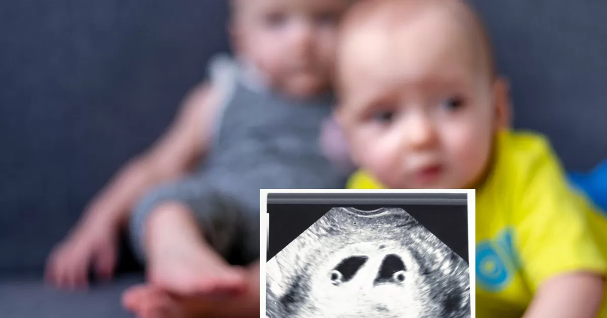 ภาวะแทรกซ้อนครรภ์แฝด