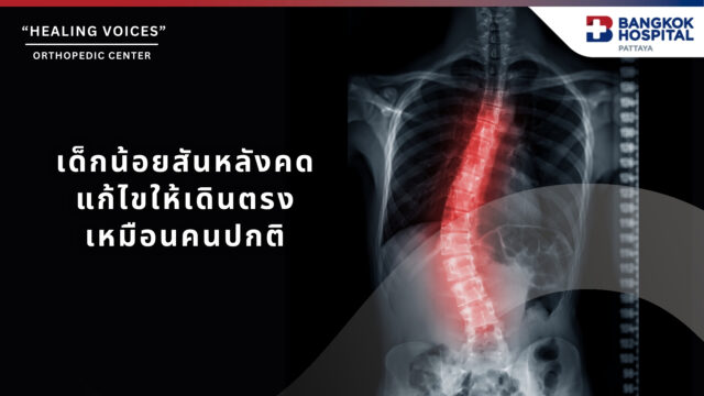 การผ่าตัดรักษาโรคกระดูกสันหลังคดในเด็ก Image