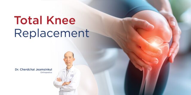Total Knee Replacement