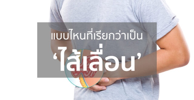 โรคไส้เลื่อน (Hernia) Image