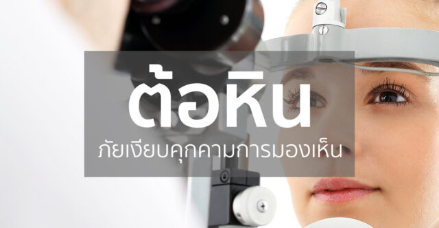 ต้อหิน : Glaucoma Image