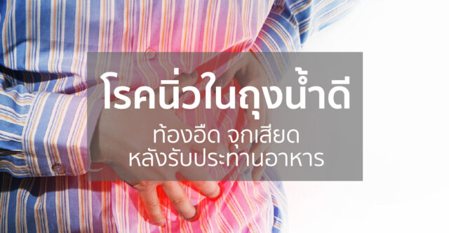 โรคนิ่วในถุงน้ำดี Image