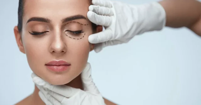 Blepharoplasty