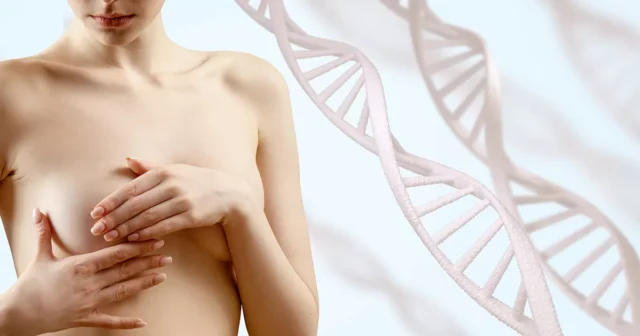 Breast Lift (Mastopexy)