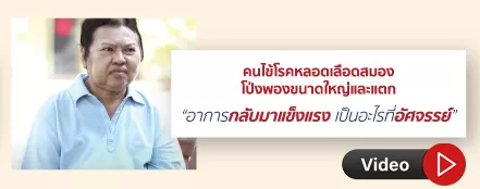 strokeoutcome Stroke