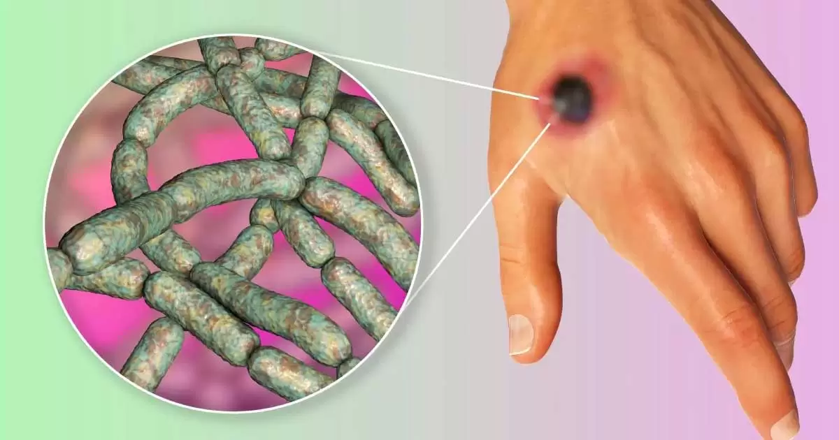 Doctor article image