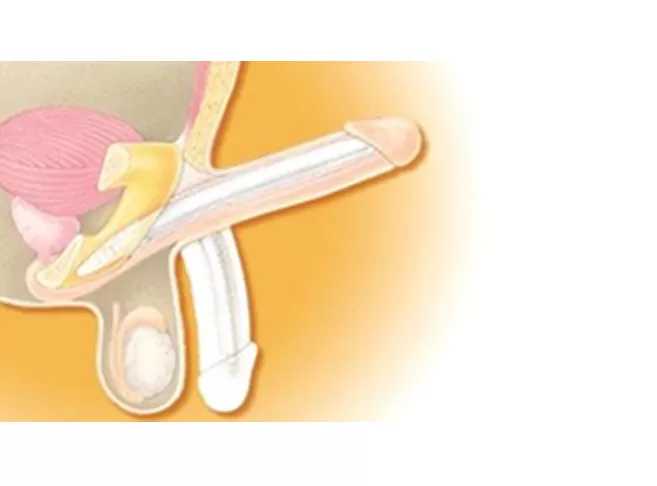 Erectile dysfunction04