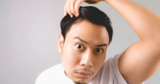 Hair Loss Image