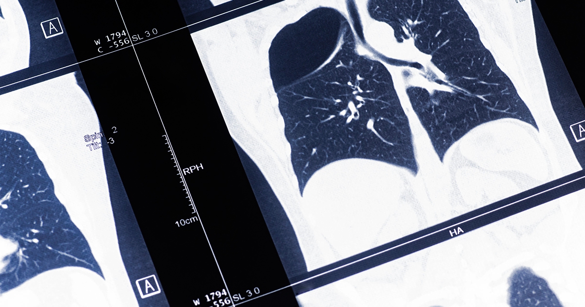 Doctor article image