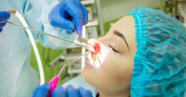 Surgical Treatment Guideline for Snoring or Sleep apnea Image