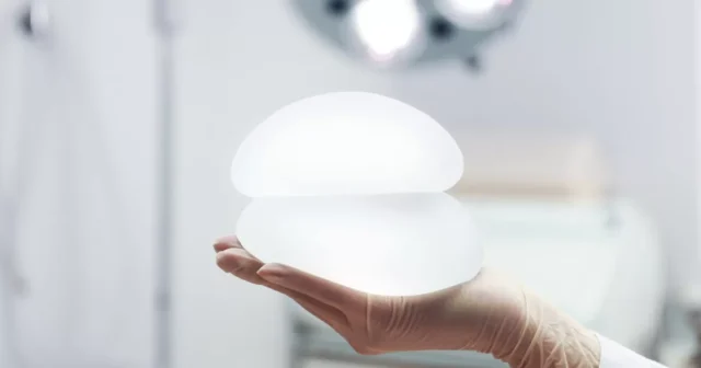 Motiva硅胶的优点 Image