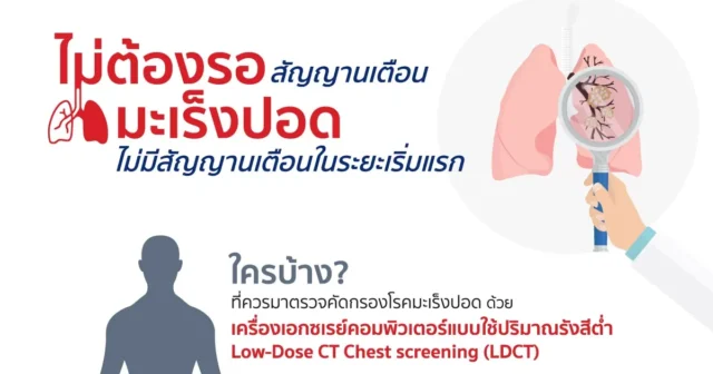 ไม่ต้องรอสัญญานเตือนมะเร็งปอด ไม่มีสัญญานเตือนในระยะเริ่มแรก