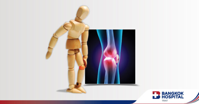แบบประเมินระดับความเสื่อมข้อเข่า