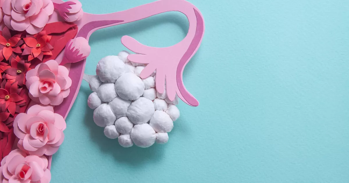 ถุงน้ําในรังไข่หลายใบ อันตรายไหม