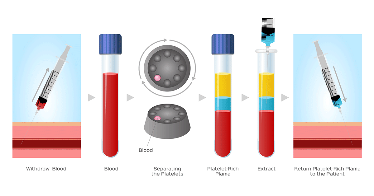 Doctor article image