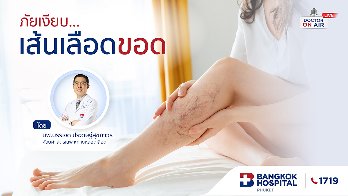 ภัยเงียบ เส้นเลือดขอด