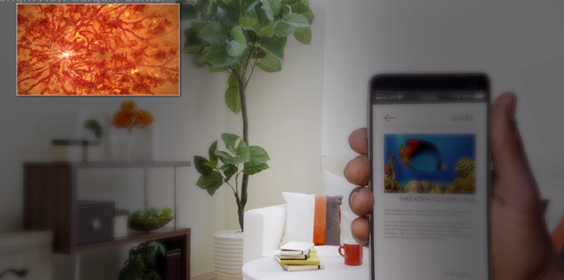 ภาพจำลองอาการตามัวที่เกิดจากภาวะเส้นเลือดในตาอุดตัน