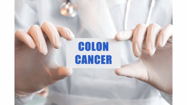 3 ปัจจัยกระตุ้น “มะเร็งลำไส้ใหญ่” ในคนรุ่นใหม่ Image