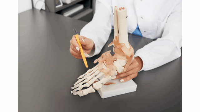 การรักษาโรคเกาต์ Image