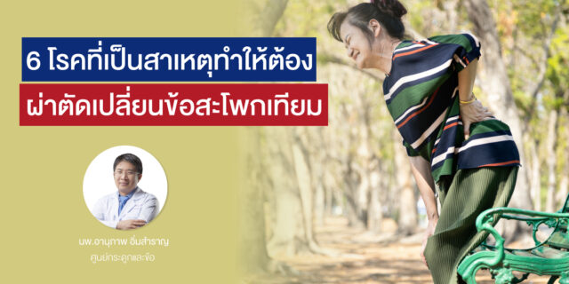 6 โรคที่เป็นสาเหตุที่ทำให้ต้อง ผ่าตัดเปลี่ยนข้อสะโพกเทียม