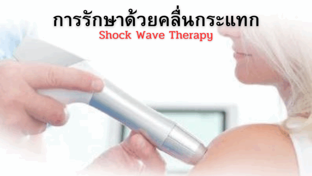 การรักษาด้วยคลื่นกระแทก Image
