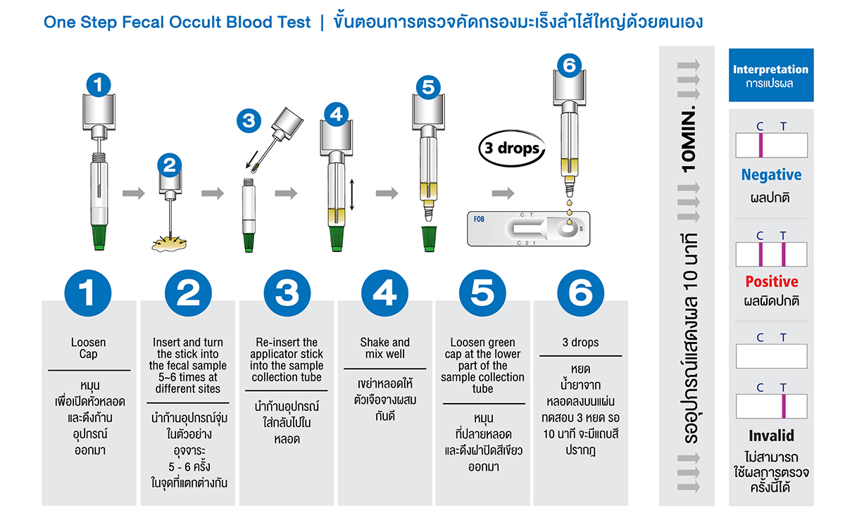 การตรวจคัดกรองโรคมะเร็งลำไส้ใหญ่ (Colorectal Cancer Screening)