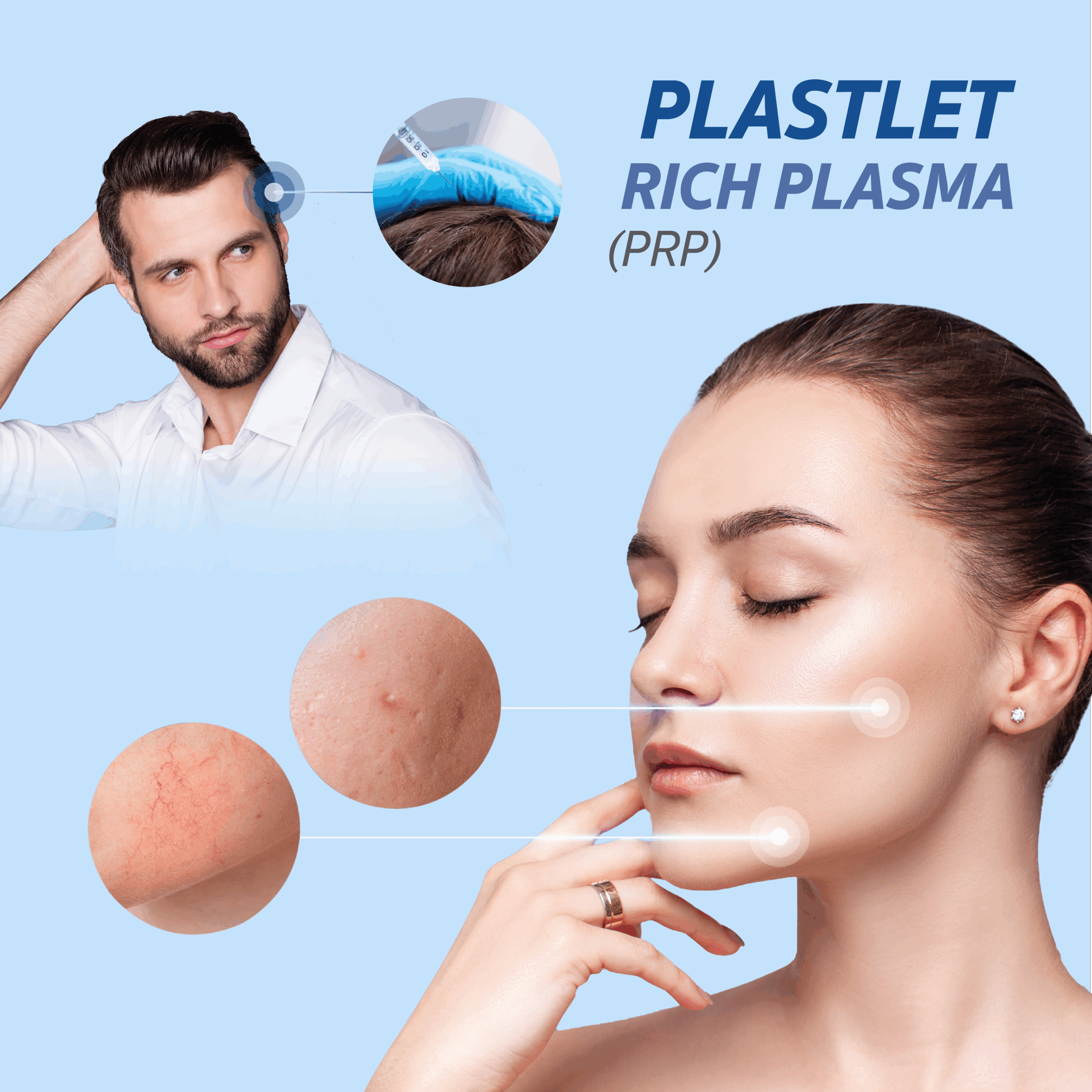 Plastlet rich plasma (PRP)