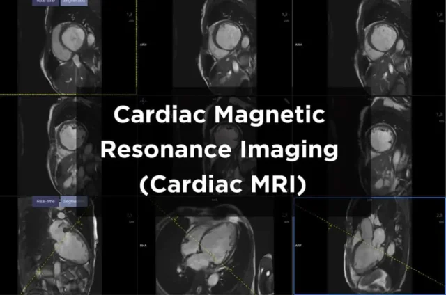 Cardiac Magnetic Resonance Imaging (MRI) scan Image
