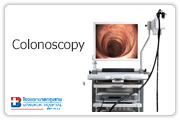 The Colonoscopy