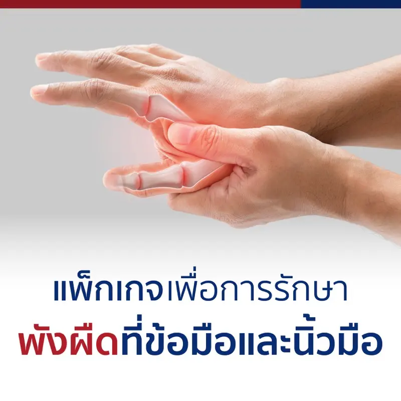 แพ็กเกจเพื่อการรักษาพังผืดที่ข้อมือและนิ้วมือ