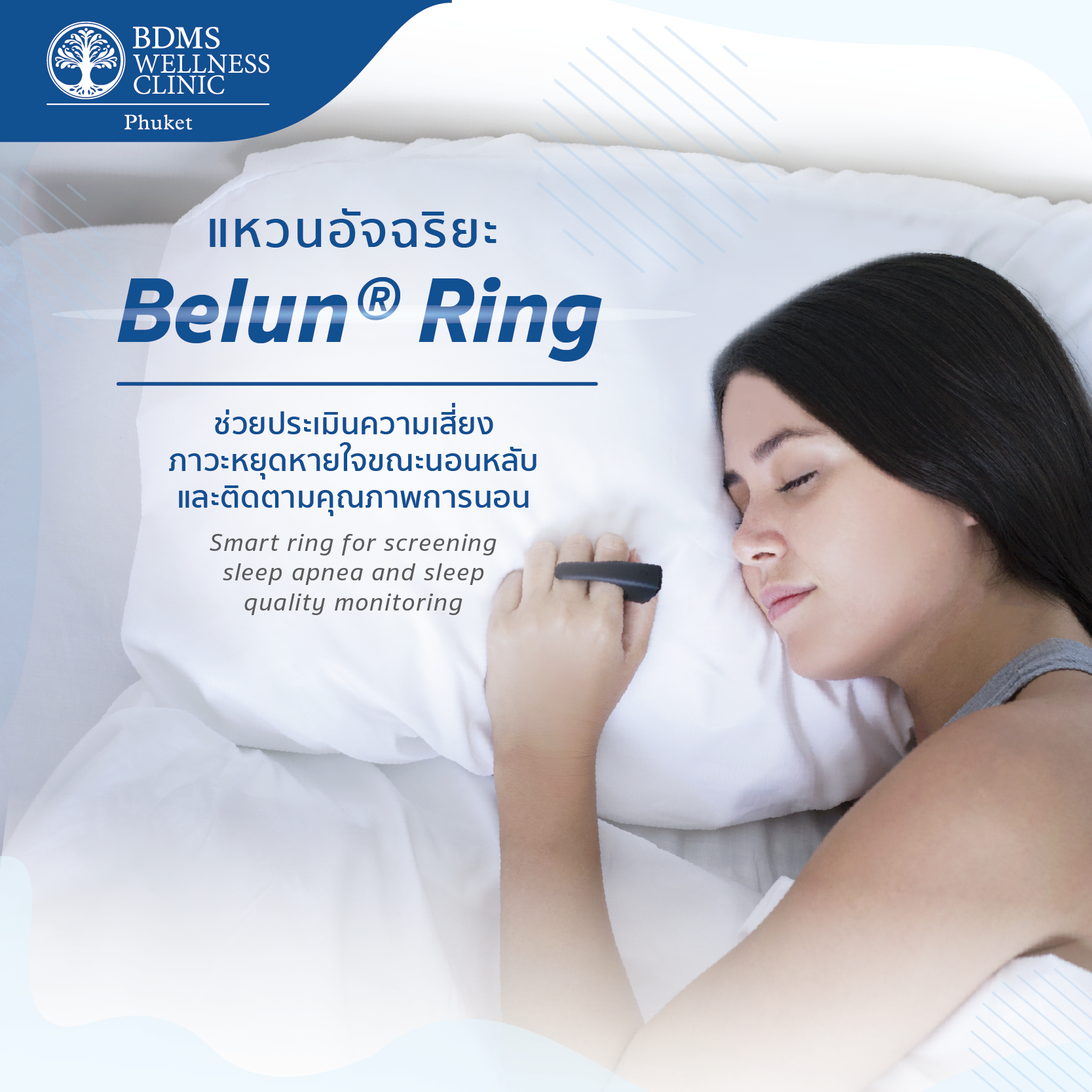 Belun Ring แหวนอัจฉริยะ ช่วยประเมินความเสี่ยงภาวะหยุดหายใจขณะนอนหลับและติดตามคุณภาพการนอน