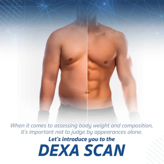 DEXA Scan
