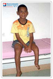 CSR Project: Donation of money for artificial leg