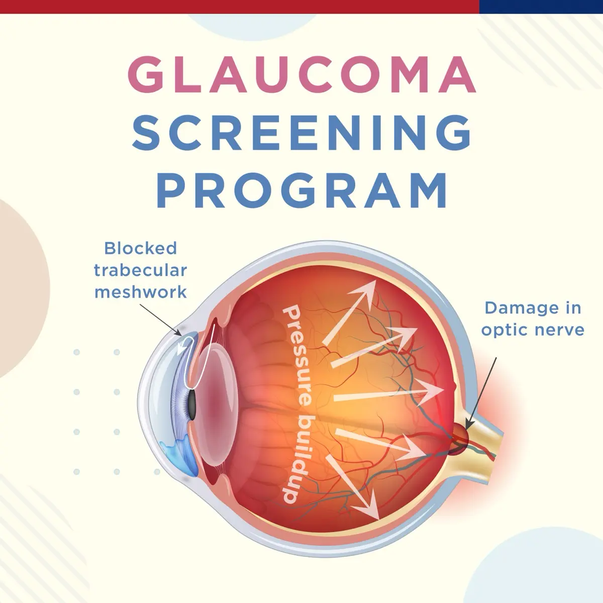 Glaucoma Screening Program