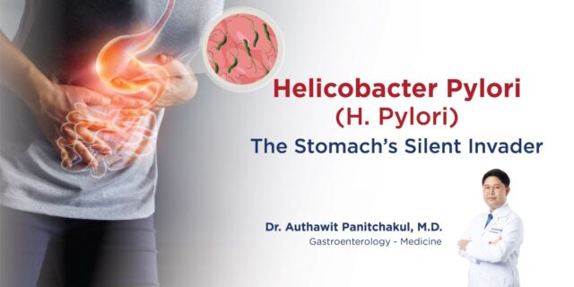 เอชไพโลไร (H. Pylori) เชื้อตัวร้ายของกระเพาะอาหาร ที่คุณไม่อยากเจอ Image