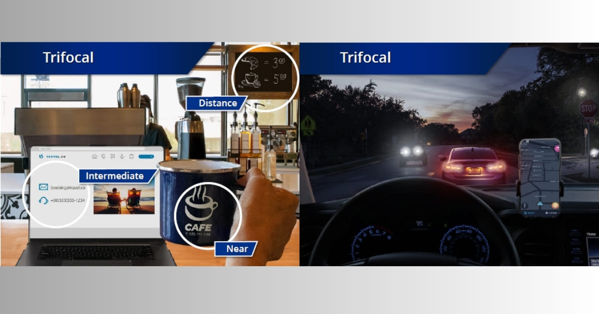 Refractive Lens Exchange (RLE) ผ่าตัดเปลี่ยนเลนส์แก้สายตาให้มองชัดทุกระยะ