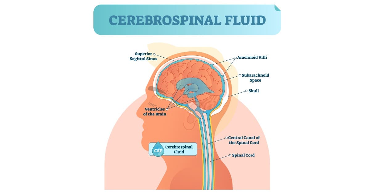 ปวดหัวจากแรงดันน้ำในสมองสูง ภัยเงียบคนยุคใหม่