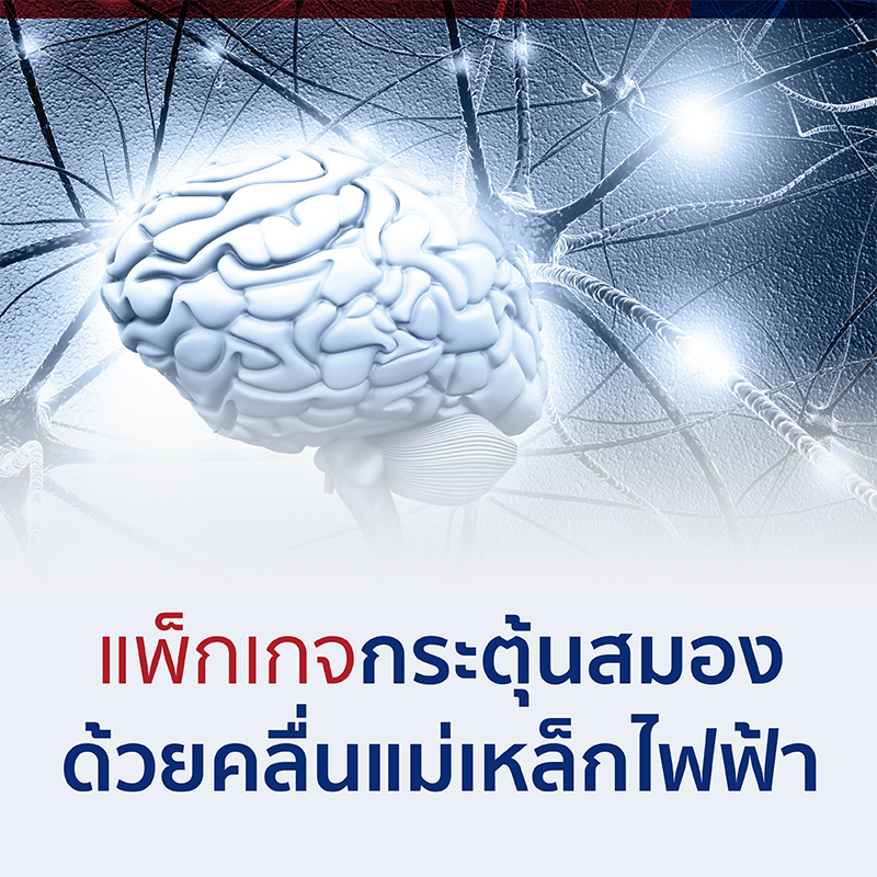 แพ็กเกจกระตุ้นสมองด้วยคลื่นแม่เหล็กไฟฟ้า (TMS)