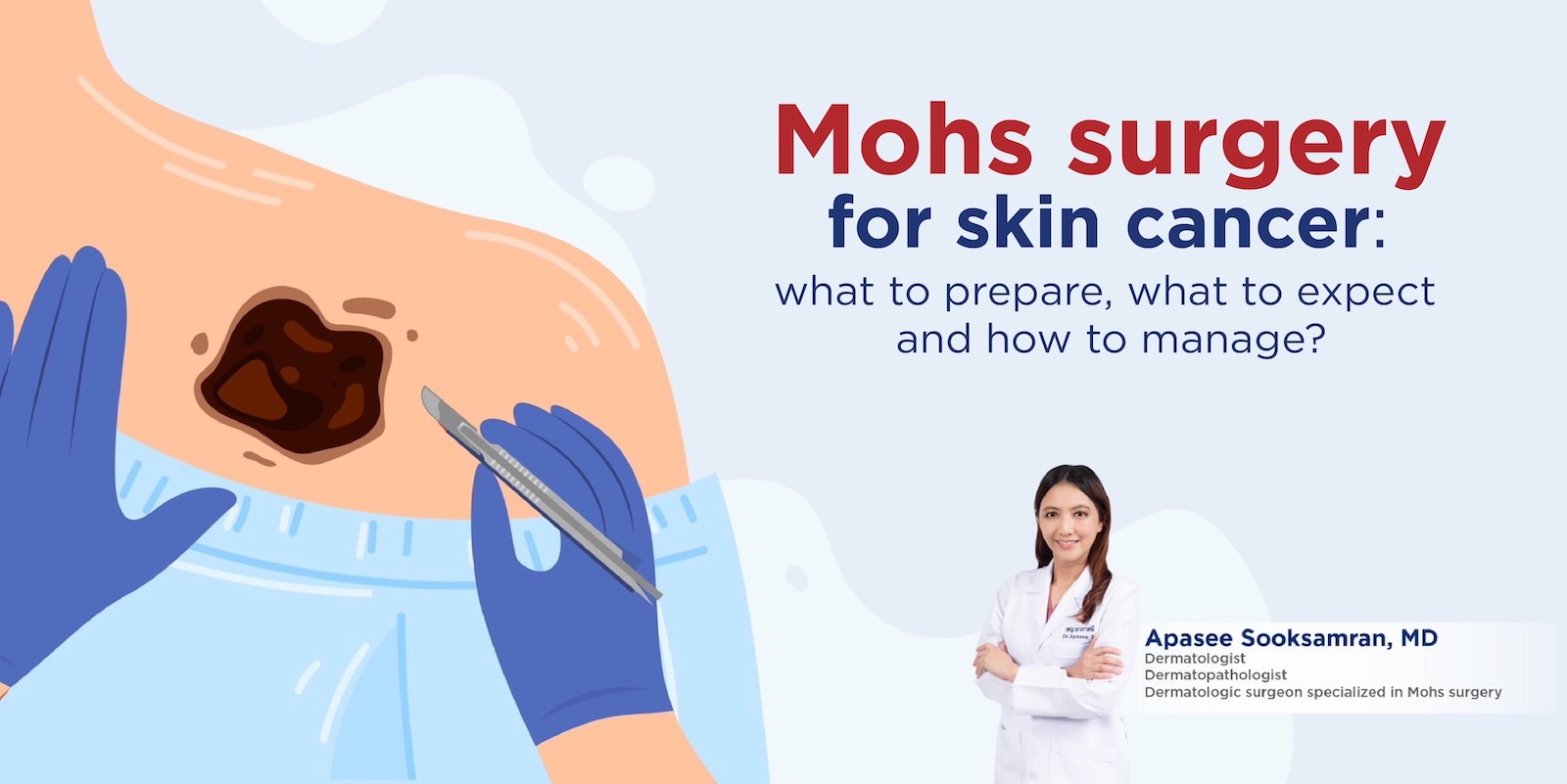 Mohs surgery for skin cancer: what to prepare, what to expect and how to manage?